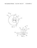 Device and Method for Retroversion Correction for Shoulder Arthroplasty diagram and image