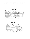 SURGICAL K-WIRE AND SURGICAL SCREW SYSTEM diagram and image