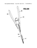 SURGICAL K-WIRE AND SURGICAL SCREW SYSTEM diagram and image