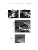 Computer Controlled Laser Therapy Treatment Table diagram and image