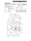 INTERSPINOUS PROCESS IMPLANT AND METHOD OF IMPLANTATION diagram and image