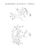 SYSTEM AND METHOD FOR FILTERING NEURAL STIMULATION diagram and image