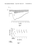 SYSTEM AND METHOD FOR FILTERING NEURAL STIMULATION diagram and image