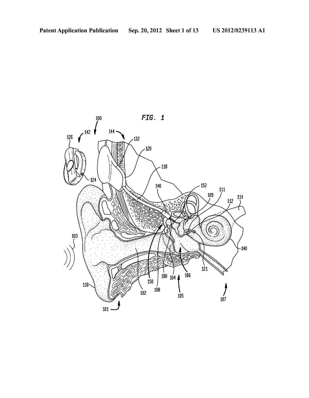 MECHANICAL STIMULATOR HAVING A QUICK-CONNECTOR - diagram, schematic, and image 02