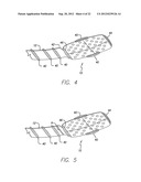 Visual Prosthesis Including a Flexible Circuit Electrode Array diagram and image