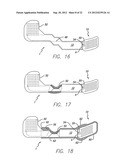 Visual Prosthesis Including a Flexible Circuit Electrode Array diagram and image