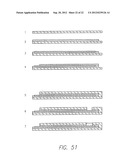 Visual Prosthesis Including a Flexible Circuit Electrode Array diagram and image