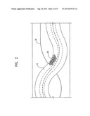 TWISTING BIFURCATION DELIVERY SYSTEM diagram and image