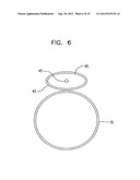 TWISTING BIFURCATION DELIVERY SYSTEM diagram and image