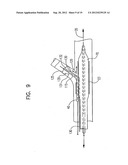 TWISTING BIFURCATION DELIVERY SYSTEM diagram and image