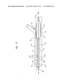 TWISTING BIFURCATION DELIVERY SYSTEM diagram and image