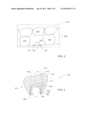 METHOD AND SYSTEM FOR DESIGNING AND PRODUCING DENTAL PROSTHESES AND     APPLIANCES diagram and image