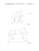 METHOD AND SYSTEM FOR DESIGNING AND PRODUCING DENTAL PROSTHESES AND     APPLIANCES diagram and image