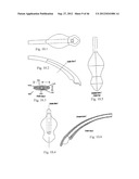 AIRWAY DEVICE diagram and image