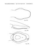 AIRWAY DEVICE diagram and image