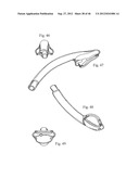 AIRWAY DEVICE diagram and image