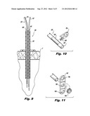 WIRE GUIDES AND ANCHORS FOR ENDOSCOPY diagram and image