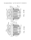 EXPANDABLE TISSUE THICKNESS COMPENSATOR diagram and image