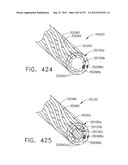 EXPANDABLE TISSUE THICKNESS COMPENSATOR diagram and image