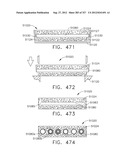 EXPANDABLE TISSUE THICKNESS COMPENSATOR diagram and image