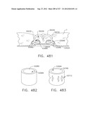 EXPANDABLE TISSUE THICKNESS COMPENSATOR diagram and image