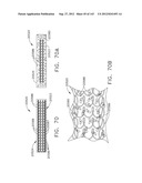 TISSUE THICKNESS COMPENSATOR COMPRISING CONTROLLED RELEASE AND EXPANSION diagram and image