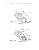 TISSUE THICKNESS COMPENSATOR COMPRISING CONTROLLED RELEASE AND EXPANSION diagram and image