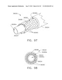 TISSUE THICKNESS COMPENSATOR COMPRISING CONTROLLED RELEASE AND EXPANSION diagram and image