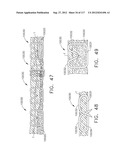 TISSUE THICKNESS COMPENSATOR COMPRISING A PLURALITY OF CAPSULES diagram and image