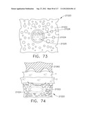 TISSUE THICKNESS COMPENSATOR COMPRISING A PLURALITY OF CAPSULES diagram and image