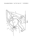 PYROTECHNIC TETHER RELEASE ASSEMBLY FOR INFLATABLE AIRBAGS diagram and image