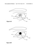 Red-Eye Removal Using Multiple Recognition Channels diagram and image