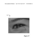 Red-Eye Removal Using Multiple Recognition Channels diagram and image