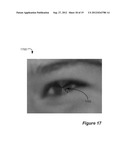 Red-Eye Removal Using Multiple Recognition Channels diagram and image