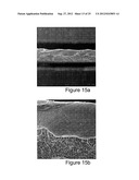 Micromachined Electrolyte Sheet, Fuel Cell Devices Utilizing Such, and     Micromachining Method For Making Fuel Cell Devices diagram and image