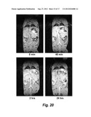 PROTEIN AGENT FOR DIABETES TREATMENT AND BETA CELL IMAGING diagram and image