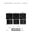 AUTOPHAGY INDUCING COMPOUND AND THE USES THEREOF diagram and image