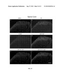 COMPOSITIONS AND METHODS FOR TREATMENT OF NEUROPATHIC PAIN diagram and image