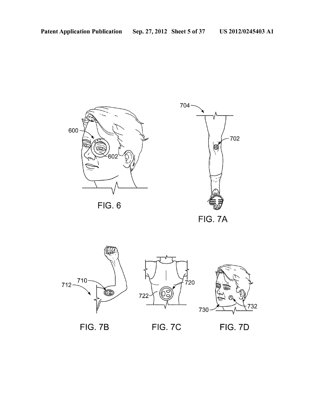 Insole Electromagnetic Therapy Device - diagram, schematic, and image 06