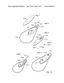 Insole Electromagnetic Therapy Device diagram and image