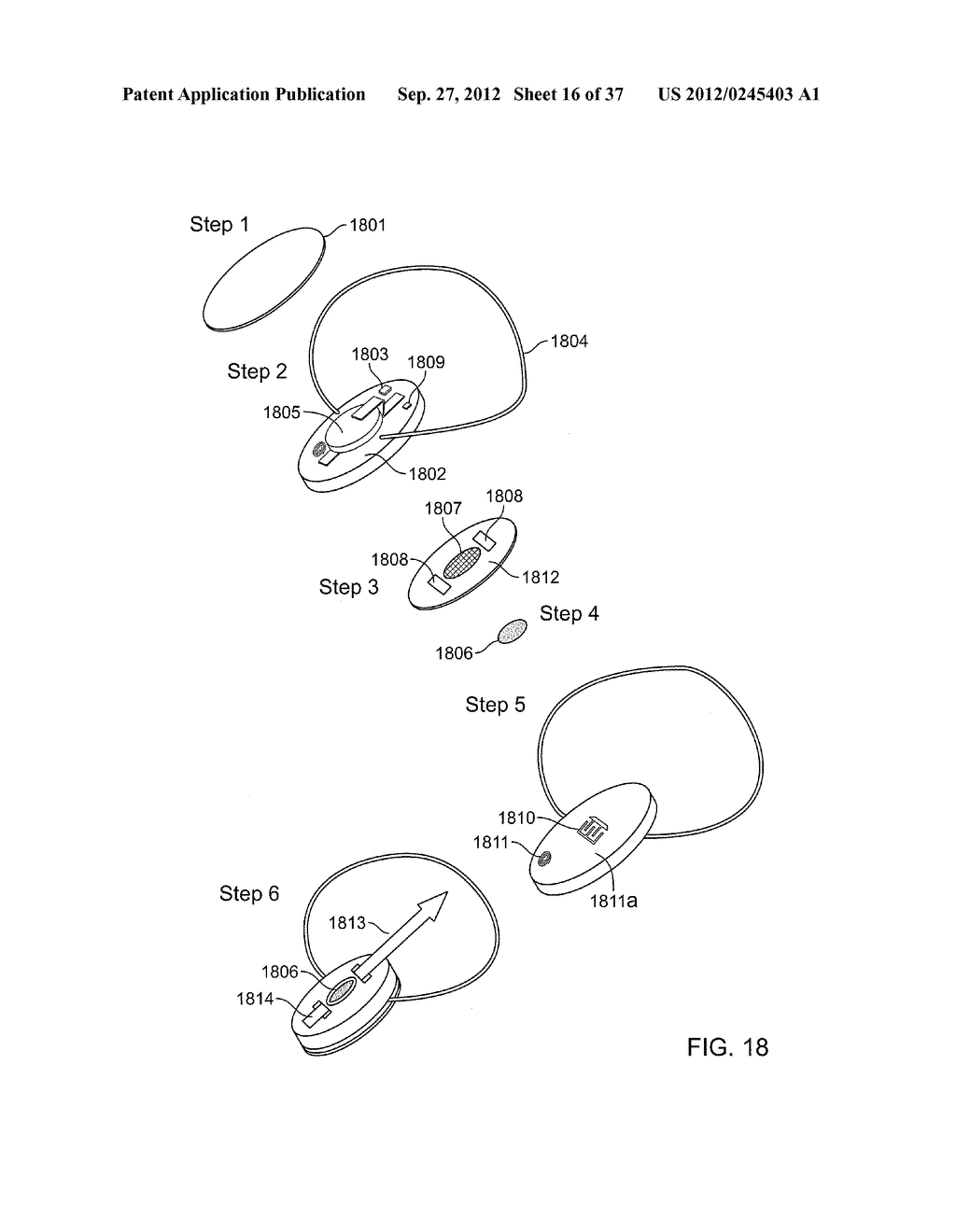 Insole Electromagnetic Therapy Device - diagram, schematic, and image 17