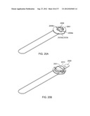 Insole Electromagnetic Therapy Device diagram and image