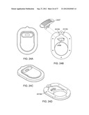 Insole Electromagnetic Therapy Device diagram and image