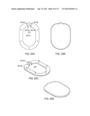 Insole Electromagnetic Therapy Device diagram and image