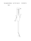 SURGICAL RETRACTOR AND USE THEREOF FOR A THORACOSCOPIC OPERATION diagram and image