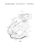 APPARATUS AND METHOD OF DETECTING MOVEMENT OF OBJECTS WITHIN THE ABDOMINAL     AND/OR PELVIC REGION diagram and image