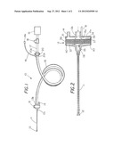 Medical devices for clearing a surgical site diagram and image