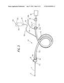 Medical devices for clearing a surgical site diagram and image