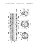 DUAL LUMEN BOND FOR VASCULAR CLOSURE DEVICE AND METHODS diagram and image