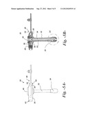 Enteral Feeding Catheter Device with an Indicator diagram and image